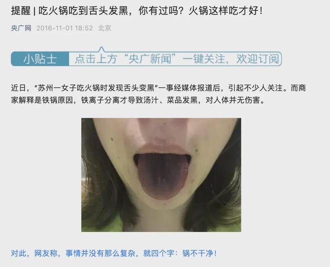 网红火锅吃完舌头发黑疑似中毒？品牌方道歉(图3)
