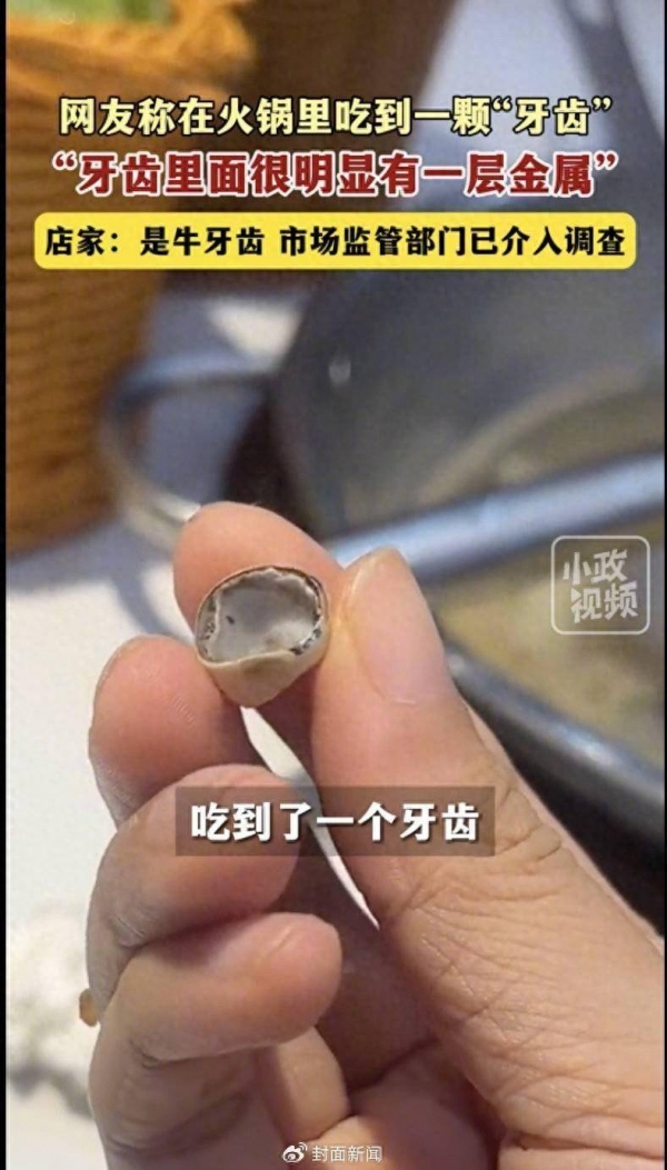 女子吃火锅在锅里吃出牙齿市监局：她当晚刷牙发现是自己的牙冠套脱落已删相关(图1)